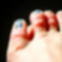 Close-up view of silicone toe protectors highlighting their texture and design